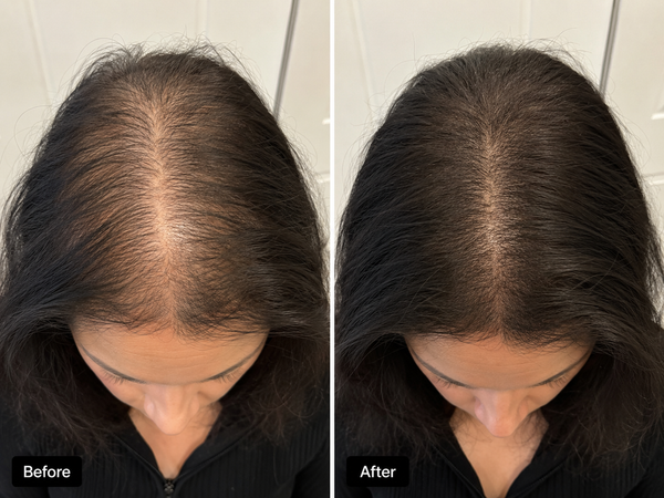 Before and after