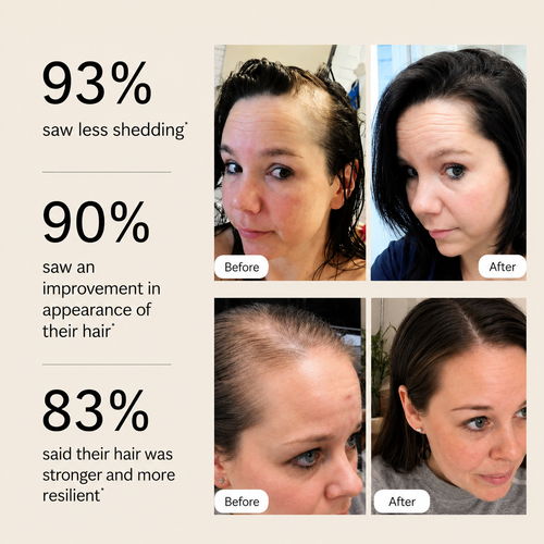 The Care-Co. 7 in 1 LED Hair Growth Massager
