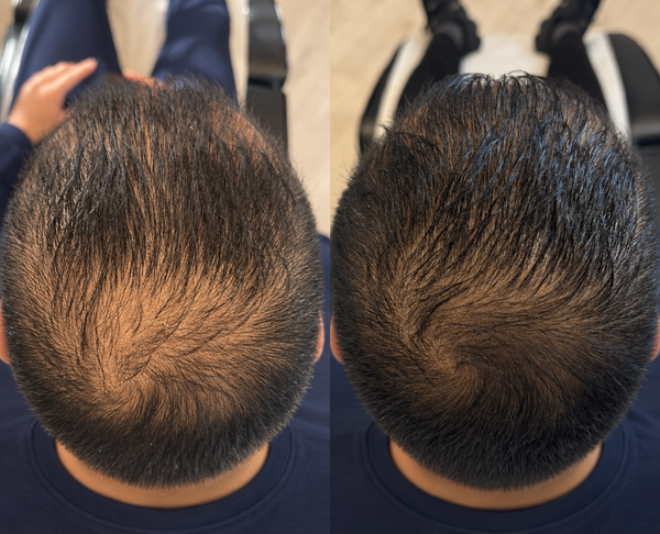 Before and after