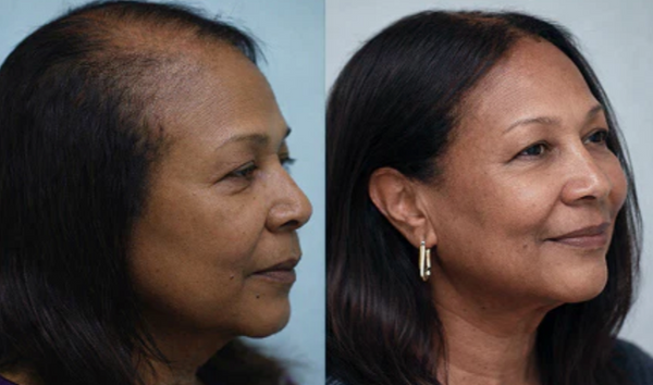 Before and after