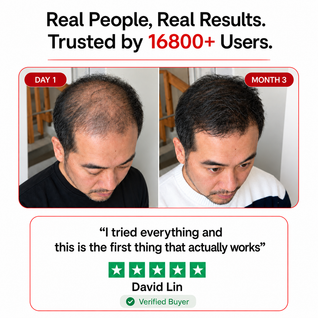 LED Hair Growth Massager