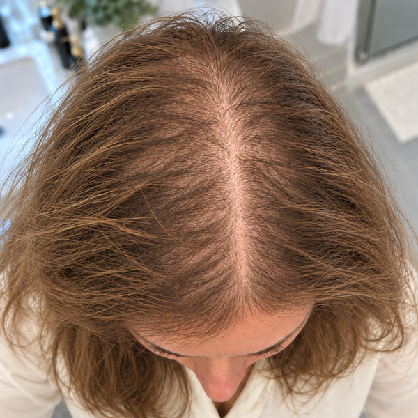 3 – 6 Months